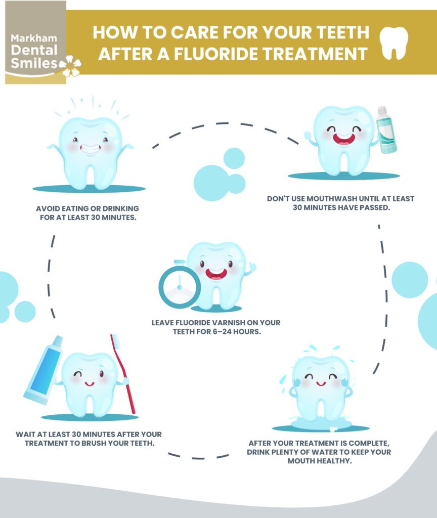 Discover The Effects Of Eating After Fluoride Treatment