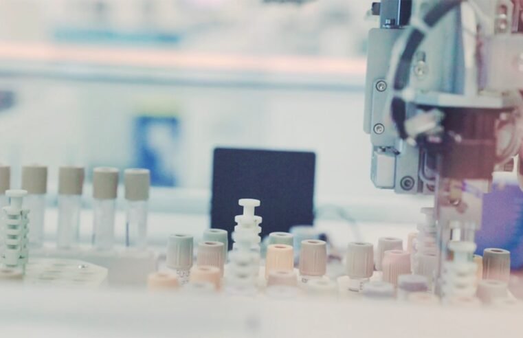How Urine Laboratories Detect Unusual Sample Characteristics